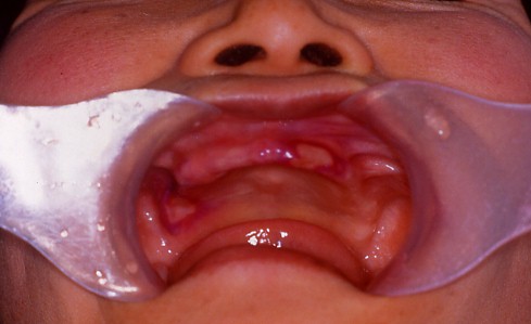 �A�t�^���������i��A�t�^�j�摜