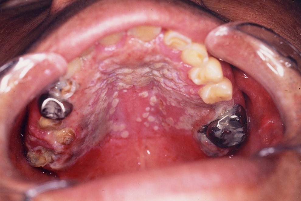 �J���W�_�ǌ��W���摜