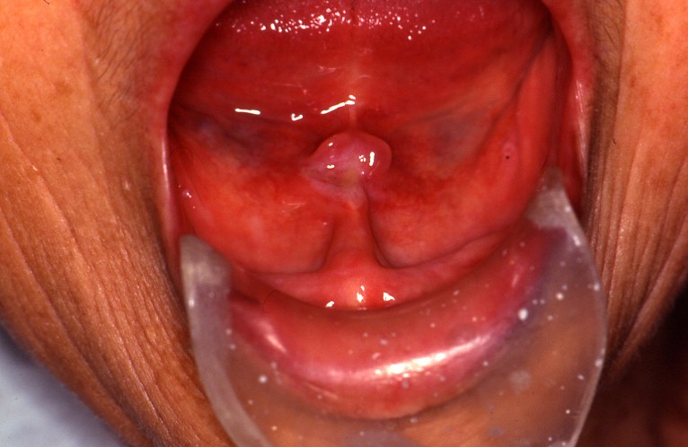 ��n����ᇉ摜