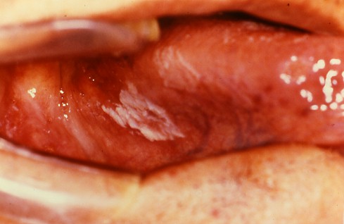 ���ǉ摜�P