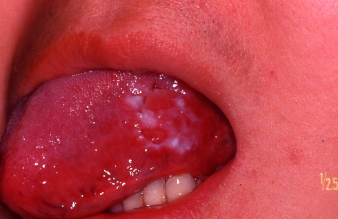 ���ǉ摜�Q