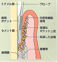 �����|�P�b�g�̌���